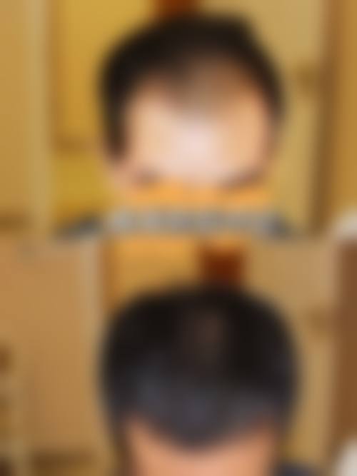 三仁医美技术设备能达到三等甲标准吗？仪器+手术技术双解析