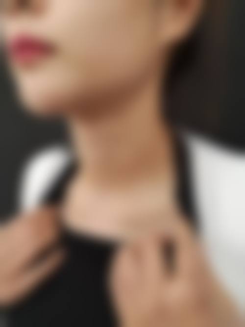 颈纹状况与治疗方案:决定你用量的关键