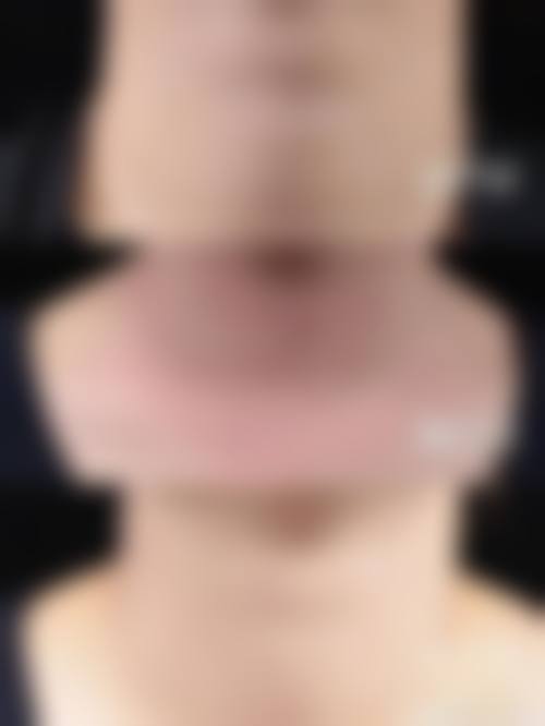 杭州天鑫医疗美容医院医生坐诊表：艾长安隆鼻、胡柏眼袋、朱斌堂嗨体去颈纹，专业团队打造自然美