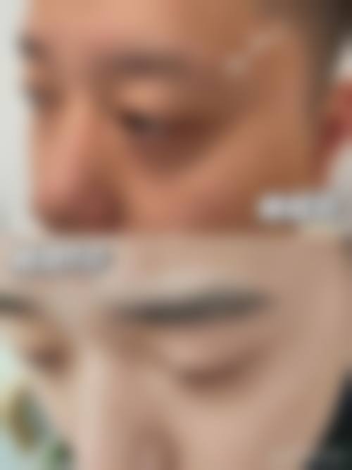 沈阳纹眉正规医院/门店怎么选？认准这几点不踩雷