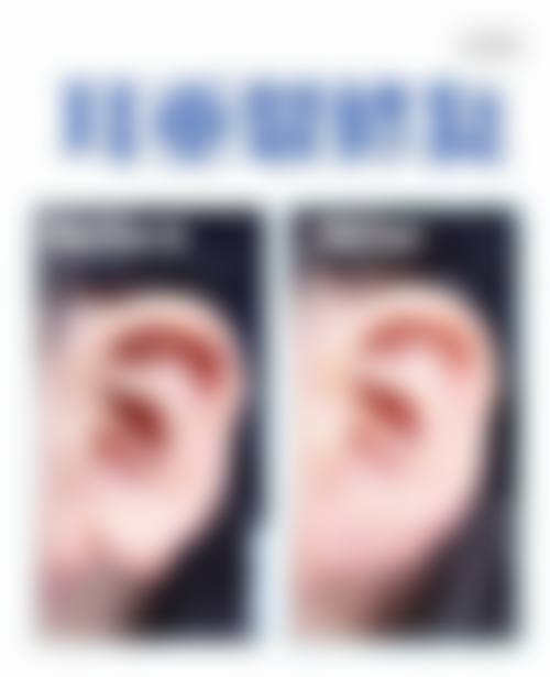 2、苏州义耳医院是三等甲吗:苏州市立医院整形科