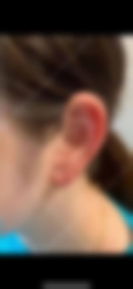 三、沈阳国内耳再造手术谁做得好收费标准的相关内容