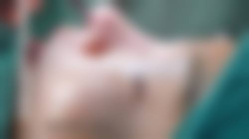 韩国优雅人整形外科医院鼻修复800万韩币起成效如何?