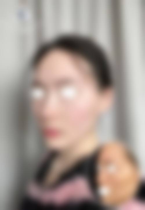 预约前必看!这些避坑要点你得知道