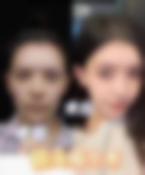 韩国优雅人整形外科医院的技术优势体现在哪里?