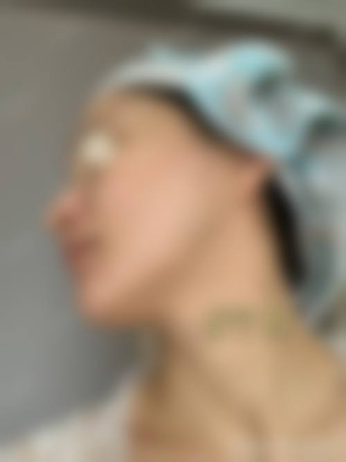 磨骨技术实力:高俊明院长的“多能面雕王”不是吹的