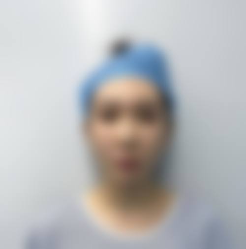 深圳其他可做人中整形的医院信息