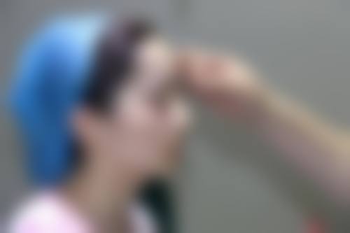 优雅人鼻修复技术有何独特之处？四大核心技术解密