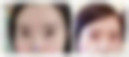 赴韩整形如何避坑？优雅人医院给出的5条专精建议