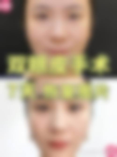 七、相关科普内容推荐