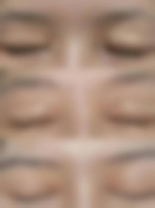 三、郑金满医生擅长项目与适合人群