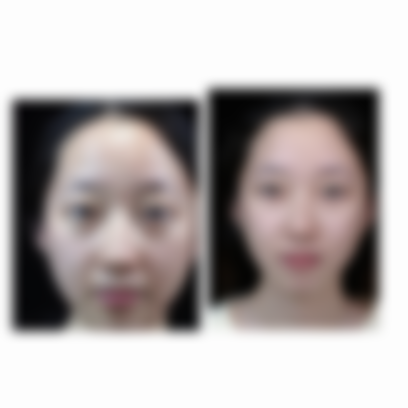 八、真实声音：复旦大学附属华 山医院怎么样？患者口碑与实例参考