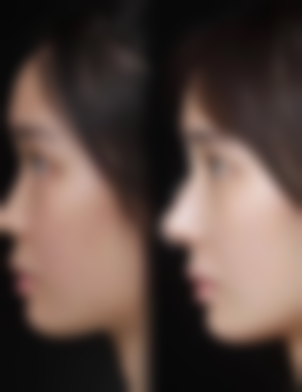 杭州天鑫医疗美容医院正规吗，靠不靠谱？