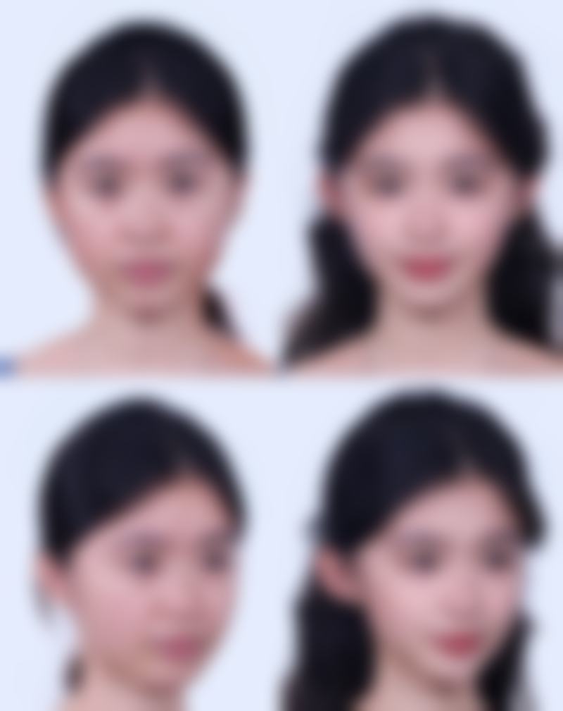 三、上海华 山医院整形外科哪个医生好？具有影响力骨干医生团队盘点！