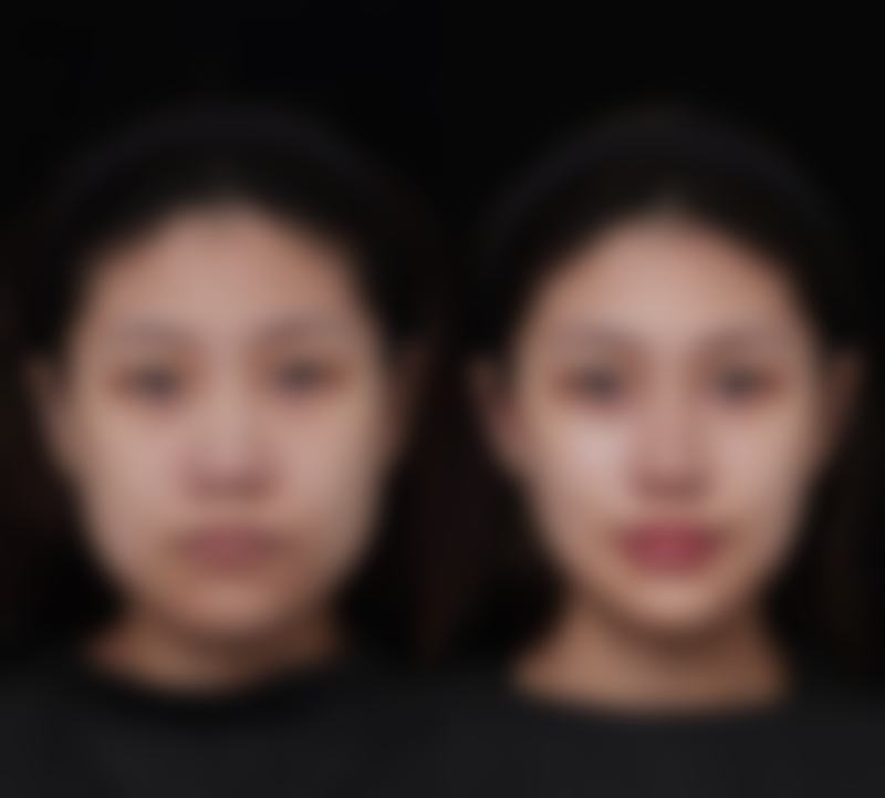 三水、南海、二院：专精私密整形团队+精良技术双重护航