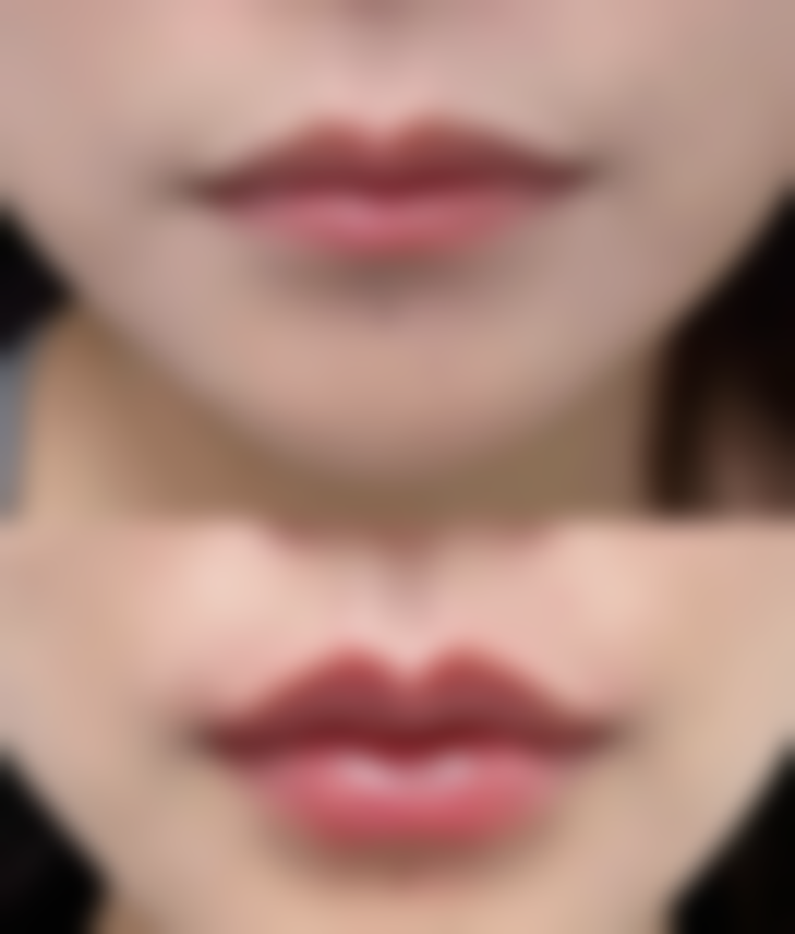 杭州连天美整形医院预约挂号方式有哪些?