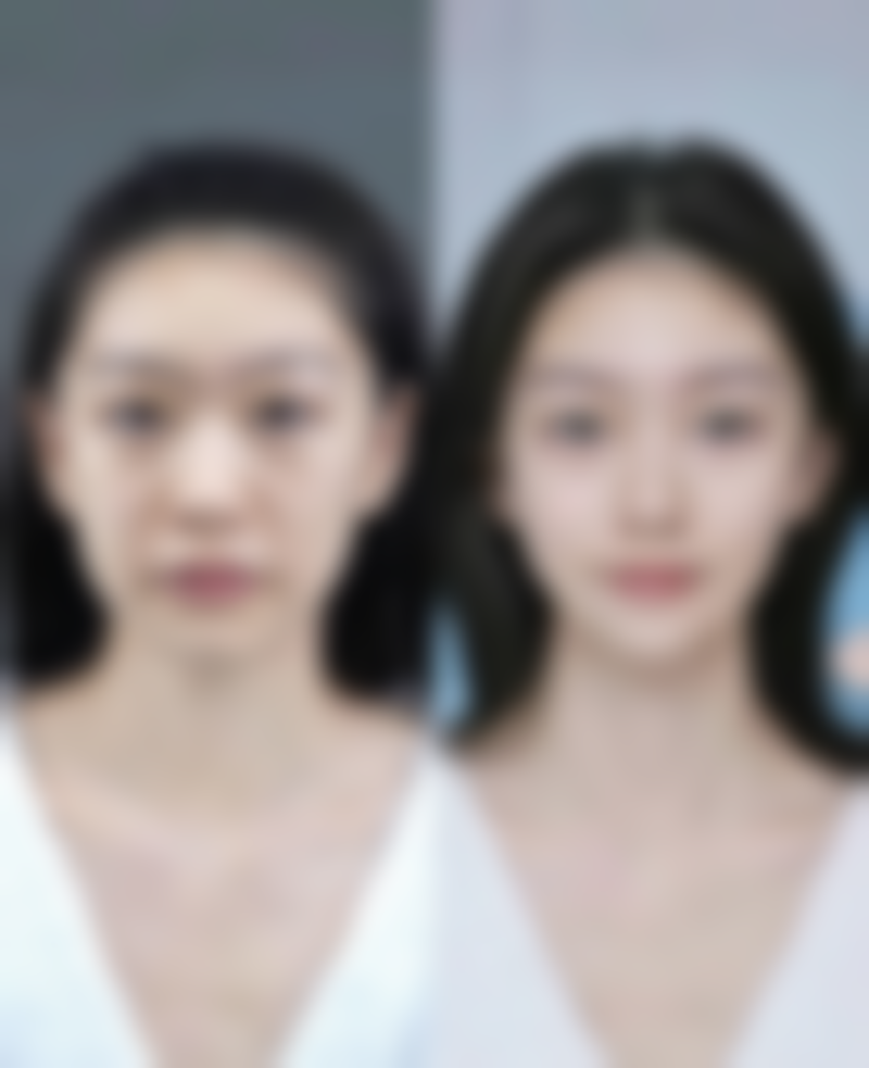 地区价格差异对成都乳房再造手术的影响