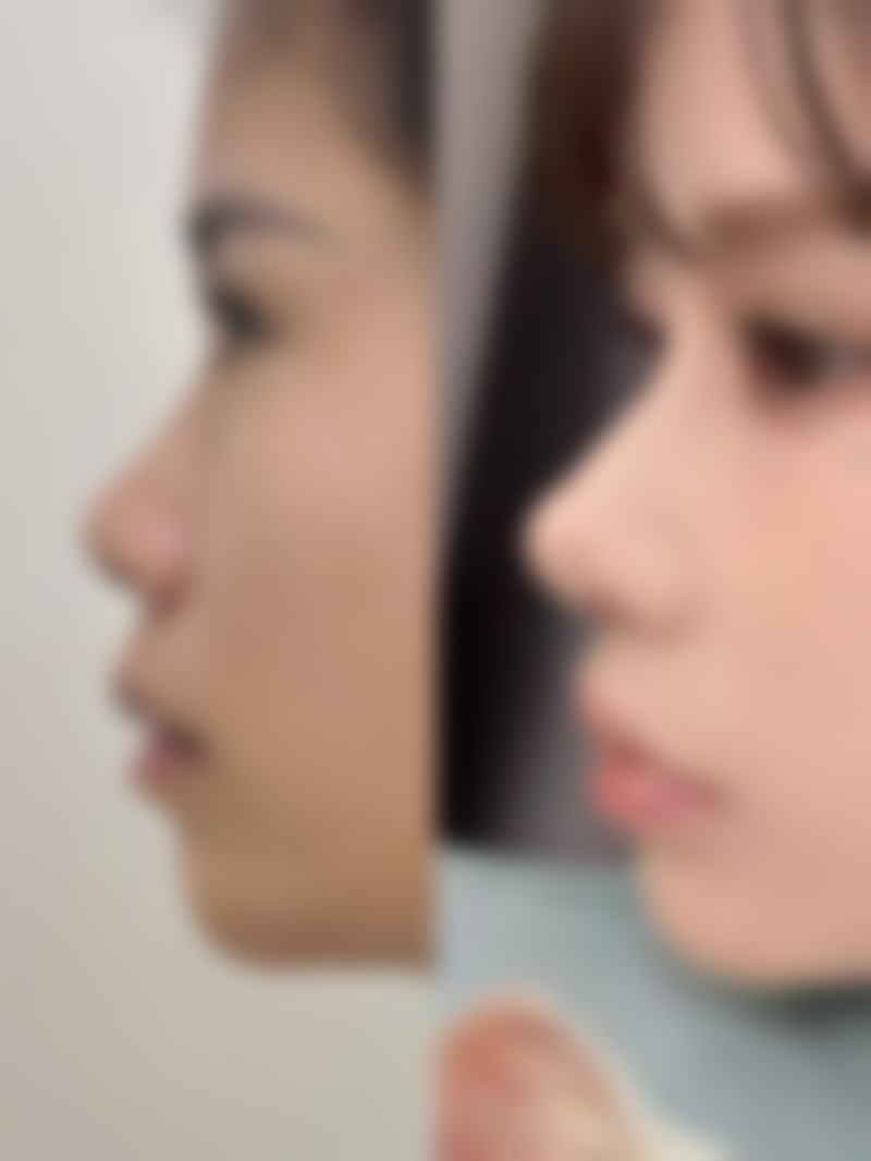 深圳艺星医疗美容医院是三甲医院吗？不是，它是正规连锁医美医院，口碑还挺靠谱！ 