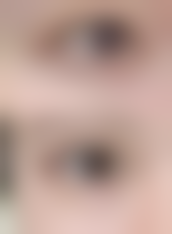 六、郑金满医生口碑和评价高