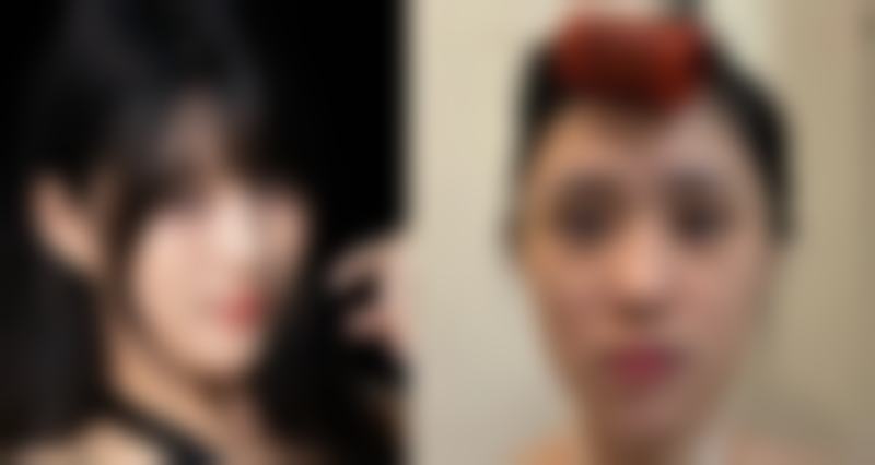 第一名：上海时光整形外科医院——隐痕术的佼佼者