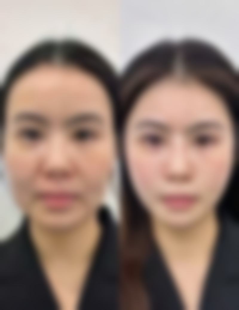 八、真实体验分享：在龙岗中 心医院做整形是种什么感受？