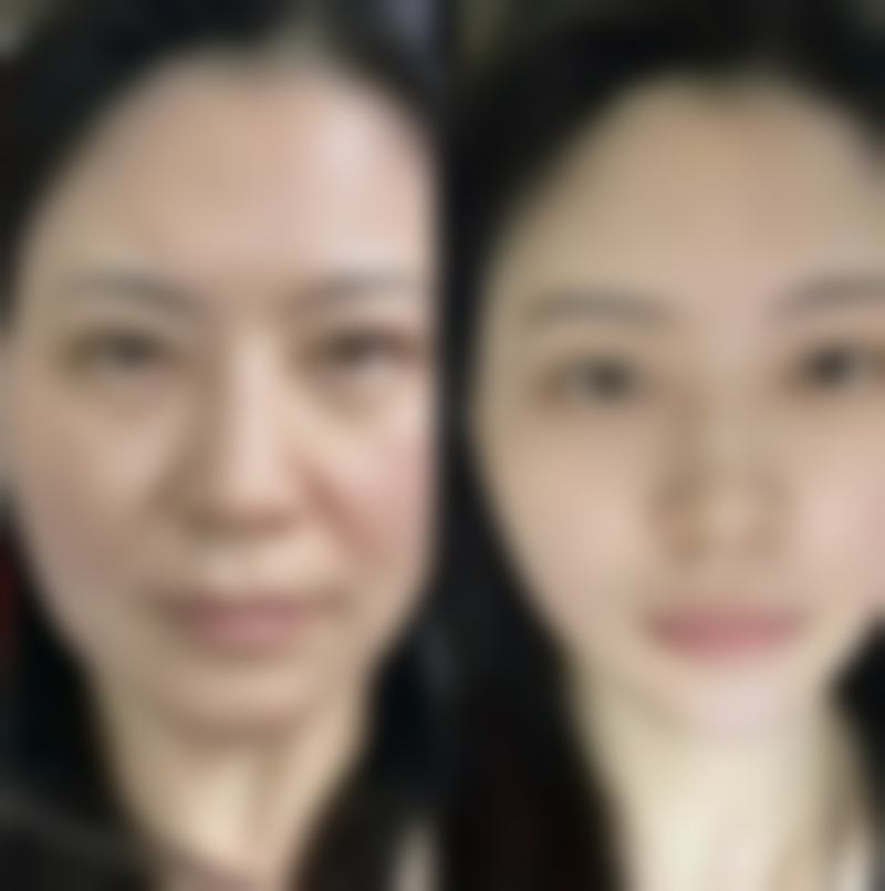 深圳龙岗中心医院整形外科在线咨询与预约，找王传家主任看双眼皮、隆鼻，出诊时间周一到周五上午！