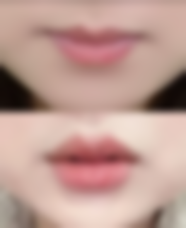 三、龙岗中 心医院整形科到底怎么样？三等甲国有医院的实力盘点