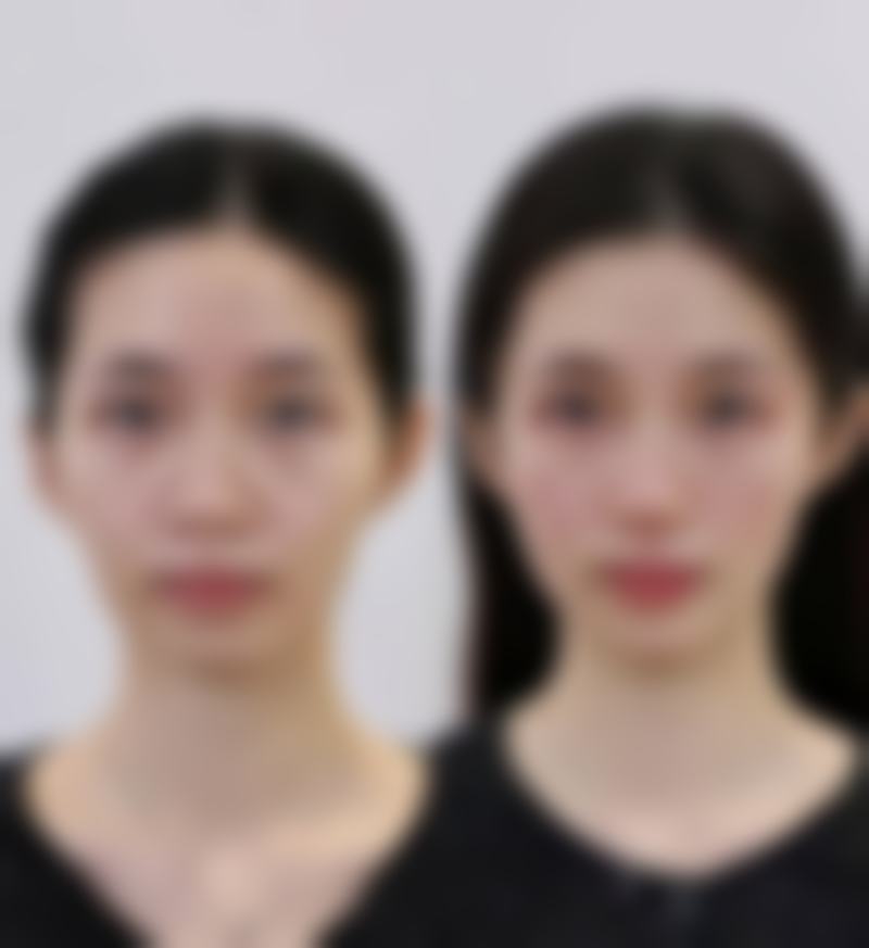 朴哲佑院长亲诊有多香?技术+审美双在线