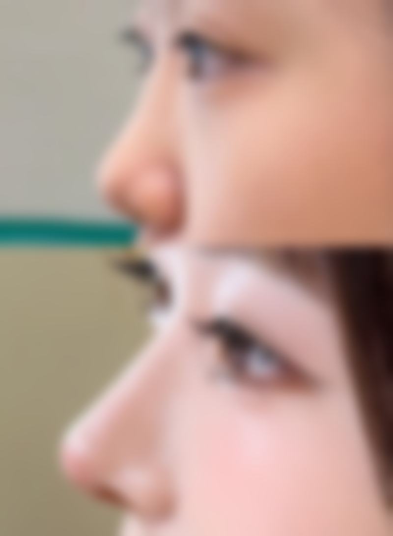 六、除了整形，复旦大学附属华 山医院皮肤科也是王牌！