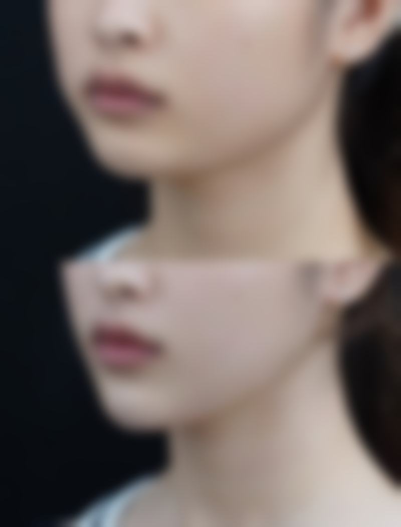 3. 西安画美医疗美容医院——两万平全科整形航母