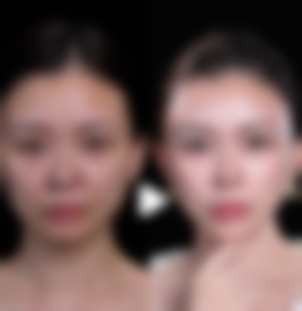 武汉生发针不同项目价格差异