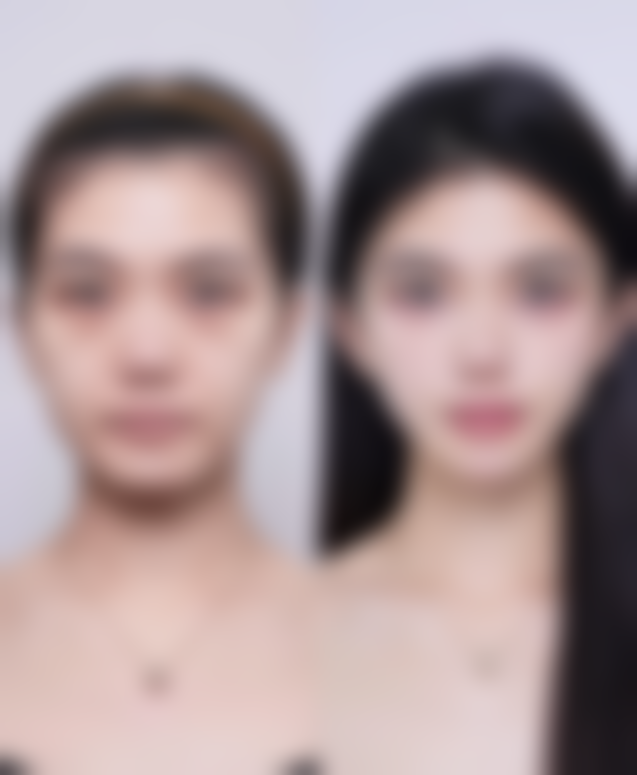 七、深圳艺星医美避坑小贴士：预约&面诊必知的关键要点