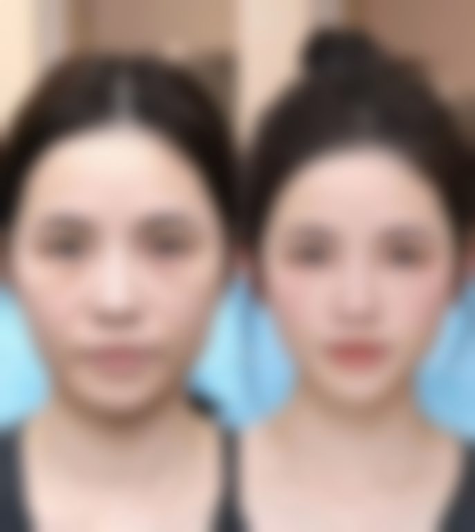 杭州连天美医院公交路线详解，便捷直达上城区秋涛路专业医美殿堂。