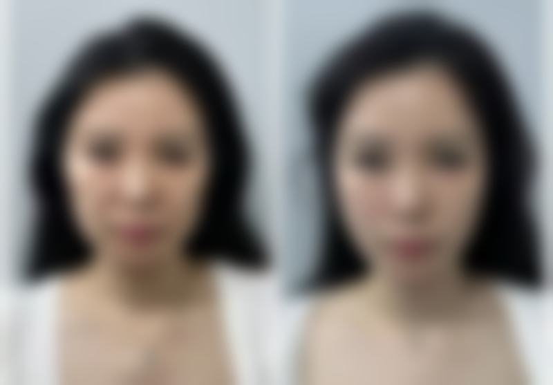 沈阳阴茎入珠术医院如何选择?