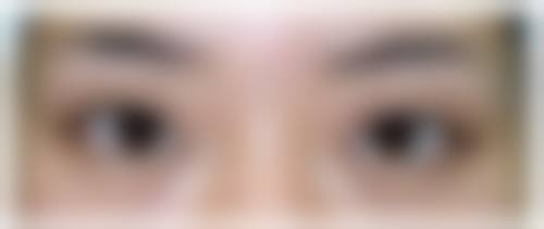 大连爱德丽格医疗美容门诊部是私人的还是公立的？答案：私立！刘志刚金刀奖团队亲诊眼部整形