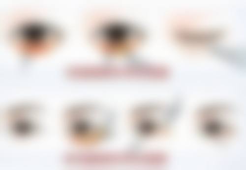 深圳艺星项目价格贵吗？常见项目参考价+省钱攻略，性价比极高！