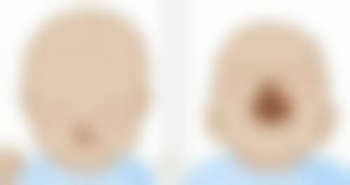 1、成都美莱医疗美容医院