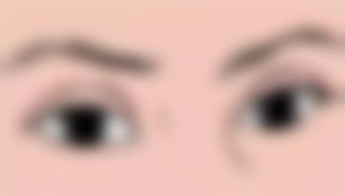 五、佛山眼周筋膜提升预约挂号攻略