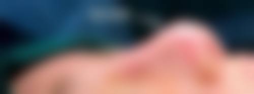 三、地址旁的颌面医生：李志海院长的超自然下颌角技术有多牛？