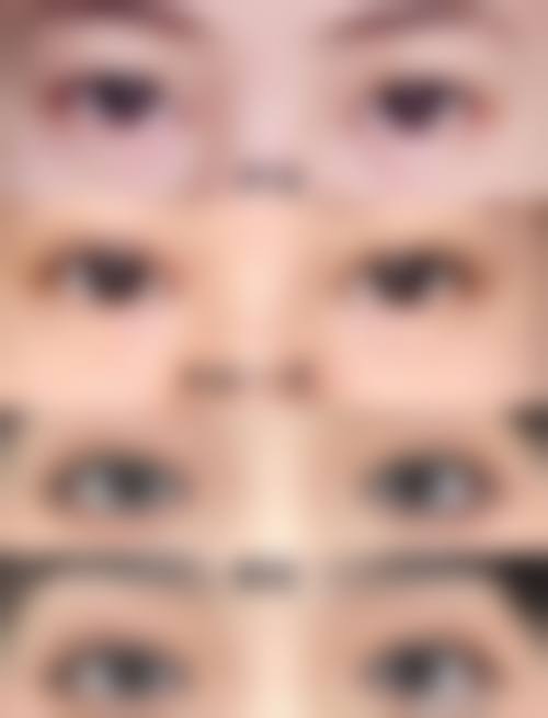 7、沈阳蒂美整形