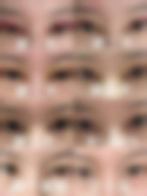 卧蚕 + 泪沟联合填充