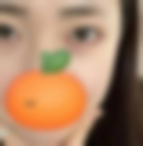 自体脂肪移植卧蚕