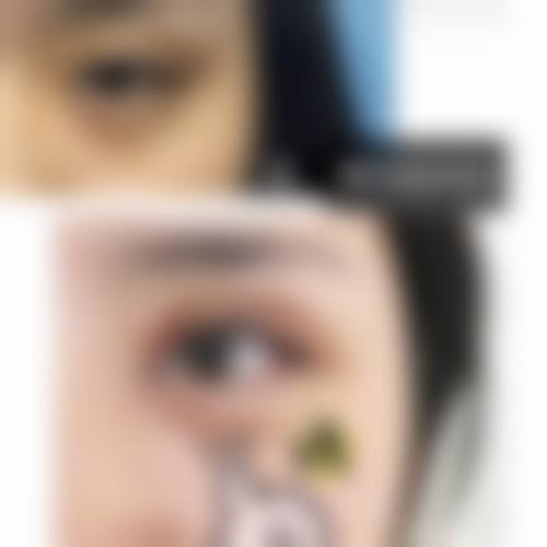 真实实例告诉你：沈阳北方整形外科医院成效到底怎么样？