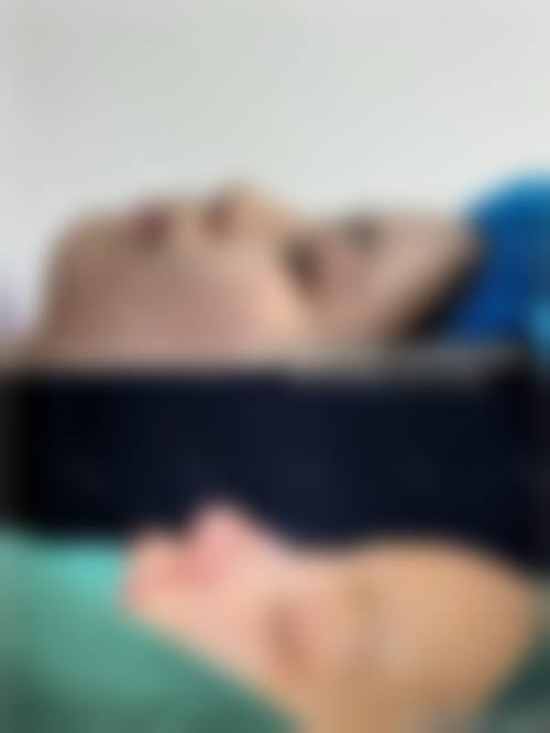 十一、在决定做完假体耳软骨隆鼻多久可以同房前，普通用户更容易忽略的关键信息