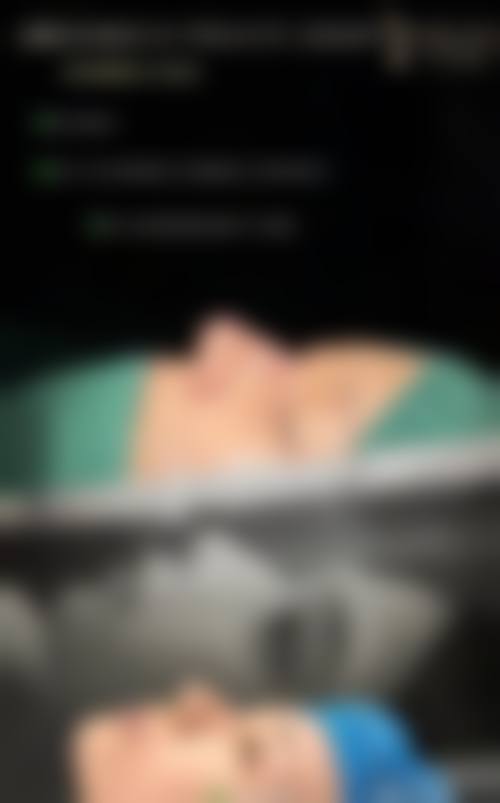 四、影响做完假体耳软骨隆鼻多久可以同房安心性的关键变量有哪些？