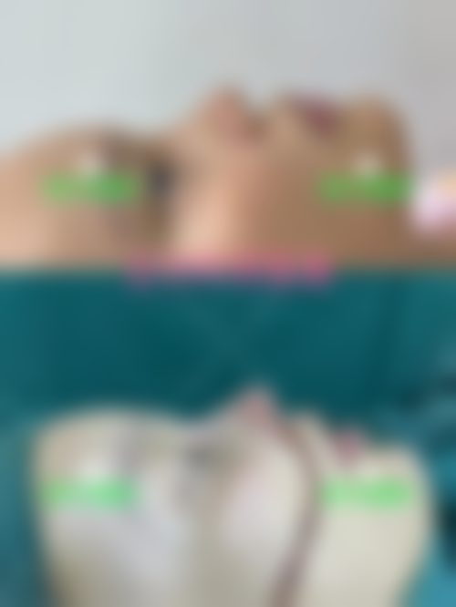 3. 成都ZZ医院眼部整形项目收费价目表