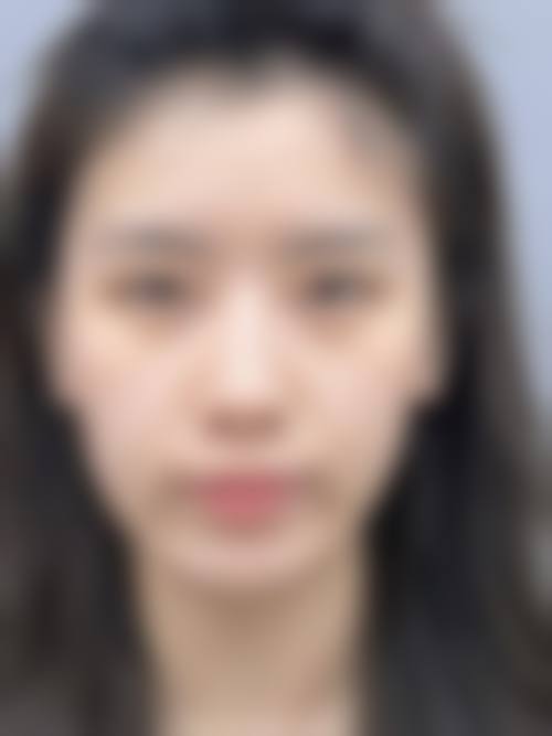 深圳艺星整形医院是正规的吗？资质许可证+连锁品牌，安心度拉满！