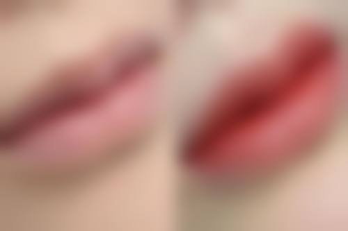 五、想知道价格？深圳人民医院整形外科价目表参考与避坑要点