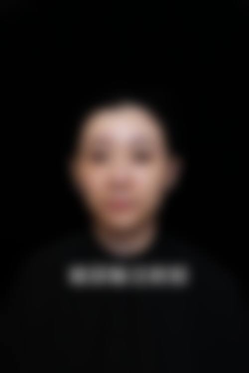 2. 成都YY医院鼻部整形项目收费价目表