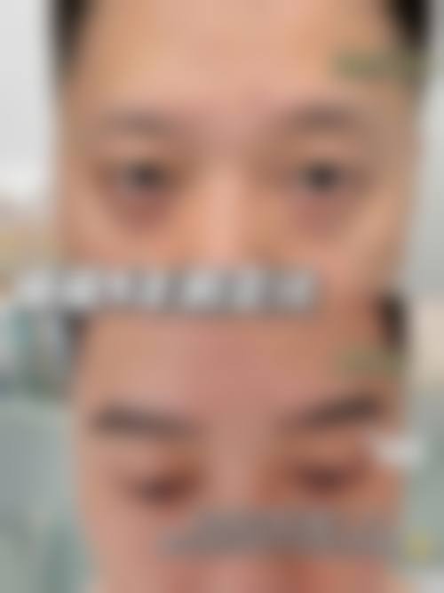 上海长征医院——上海头发种植哪个医院正规？三等甲品质之选